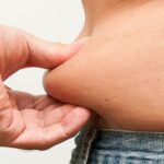 loose skin removal hawthorn