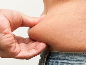 loose skin removal hawthorn