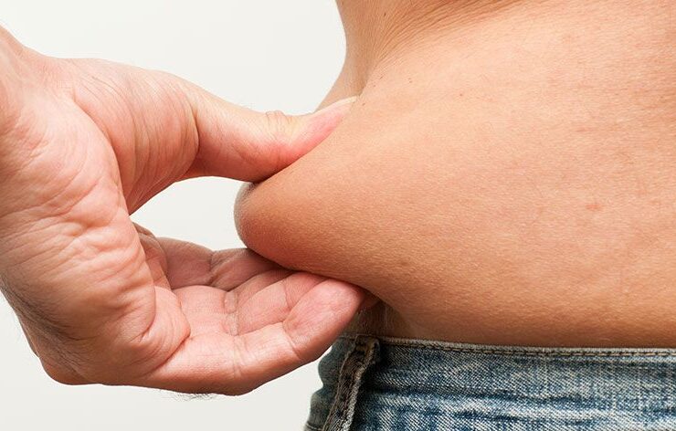 loose skin removal hawthorn